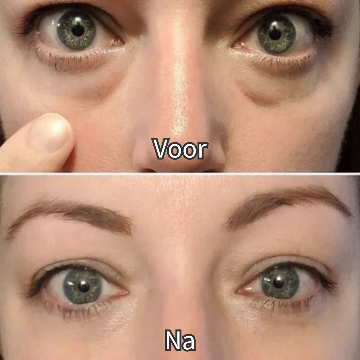 EyeShine™ | Rood Licht & EMS | Vermindert donkere kringen onder de ogen.