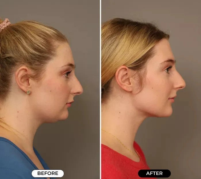 FlexiFace™ Therapy: De Ultieme 4-in-1 Massager voor Gezichtsverzorging en Ontspanning